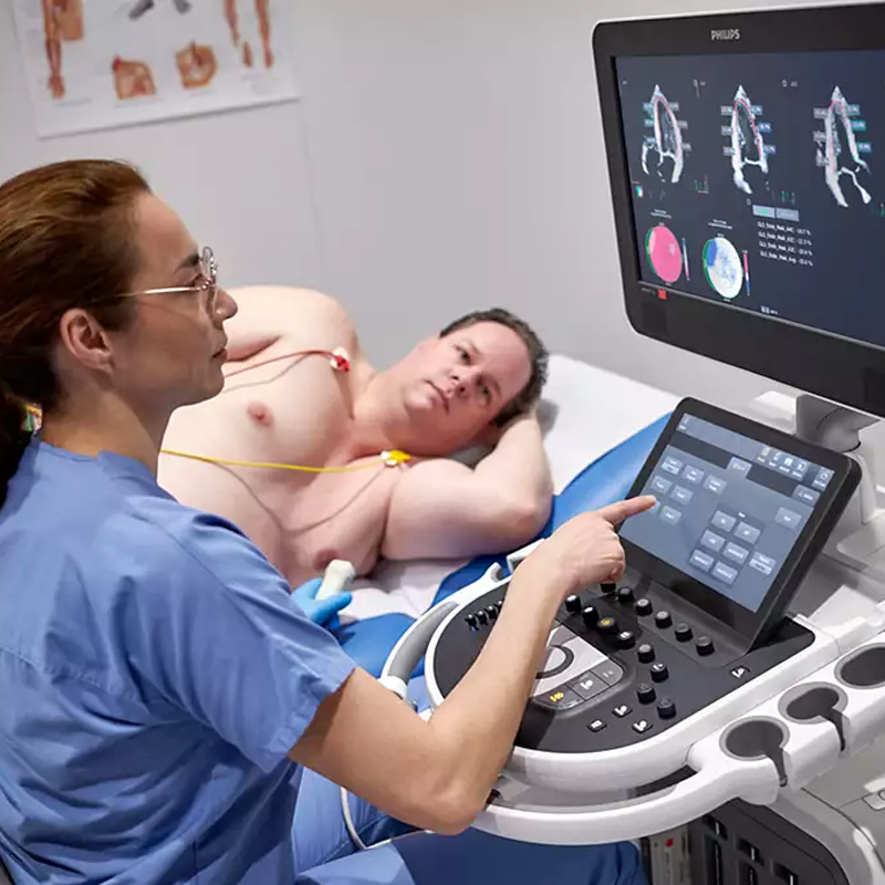 Ультразвуковая система экспертного класса Philips Affiniti CVx